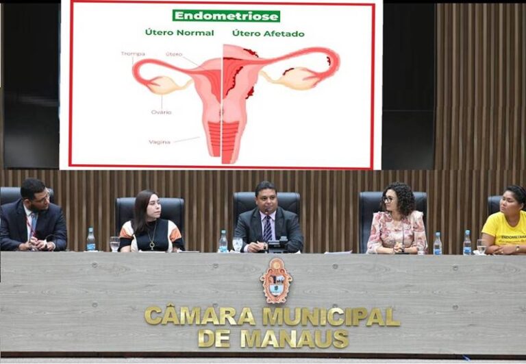 Caio André promove Audiência Pública para debater necessidades de mulheres com endometriose